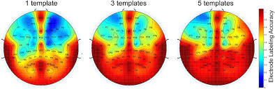 Fcz electrode is indicated by the red circle. Frontiers Semi Automated And Direct Localization And Labeling Of Eeg Electrodes Using Mr Structural Images For Simultaneous Fmri Eeg Neuroscience