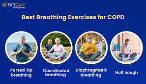Image result for Exercise in COPD