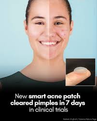 Hubble vs. James Webb: Revealing Uranus's Rings Like Never Before The  Hubble Space Telescope's image of Uranus shows a bluish sphere with faint,  blurred rings that are barely visible. Though groundbreaking at