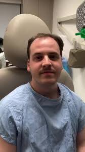 Experiencia de Trasplante Capilar Con Dr. Gary Linkov