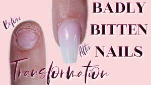 How To Apply Tips On A Bitten Nail Doing My Nails Using My Non Dominant Hand Youtube How To Do Nails Acrylic Nail Shapes Nails