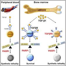 For certain types of leukemia, lymphoma, and multiple stem cell transplants are used to replace bone marrow cells that have been destroyed by cancer or destroyed by the chemo and/or radiation used to. Tgfbr Smad3 Signaling Induces Resistance To Parp Inhibitors In The Bone Marrow Microenvironment Sciencedirect