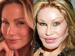 49 Celebs Who Have Aged Horribly Ripbird Page 17 Bad Celebrity Plastic Surgery Celebrity Plastic Surgery Plastic Surgery