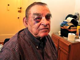 20-year-old thug accused of beating 81-year-old man did it to steal gold  chain: court records