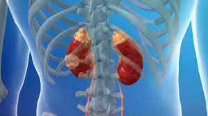 It is very important that a specialist evaluate the type and location of the kidney cysts. Kidney Cancer Willis Knighton Health System Shreveport Bossier City Ark La Tex