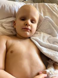 Ben Askren has been able to open his eyes and show some responsiveness 🙌🙏