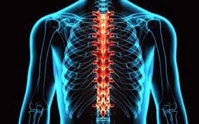 The diagnosis of thoracic disc syndrome requires a high index of suspicion and should be considered in patients with chronic abdominal pain. Mid Back Thoracic Spine Pain Causes And Treatment