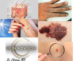 Want to consult an online dermatologist? Online Free Dermatology Consultation With Dr Ebtisam Elghblawi Home Facebook