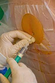 Miranda is a lioness and kasen is a wolf. Welche Auswirkungen Hat Eine Pda Periduralanasthesie Schwangerschaft Net