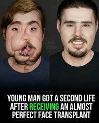 Vishal Thakkar could have his face