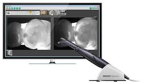 Digital imaging in dentistry / orth. Cavity Detection Technology Chicago Benjamin S Fiss D D S