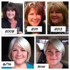 Image Result For Going Gray Before And After Pictures Going Gray Grey Hair Inspiration Grey Hair Before And After