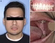 Table of Contents page: Journal of Oral and Maxillofacial Surgery