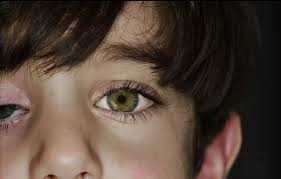 How To Use Your Camera To Detect Eye Cancer In Children