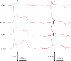 Image result for J Wave