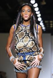 Black And White Skin Condition Model Winnie Harlow Vitiligo Winnie Harlow Vitiligo Treatment