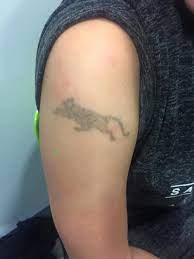 Our comprehensive list below shows all laser tattoo removal clinics in jersey. Spectrum Advanced Tattoo Removal Systems Home Facebook