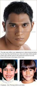 These molds, when applied at a young enough age, will reshape. Is Otoplasty Right For You Or Your Child New Orleans Facial Plastic Surgery Dr Dan Jacob New Faces