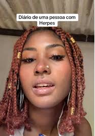 Diário de uma pessoa com herpes: Testando novos gloss