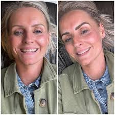 På de her to fuldface billeder af to...