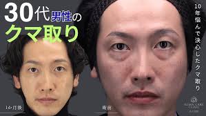 Quick Dark Circle Removal