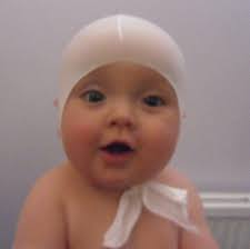 James Flat Head Solution