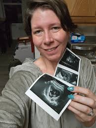 How to relieve constipation and gas during early pregnancy?