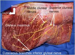 In order to determine if this condition is present, a clinical examination may be performed to determine if a patient suffers from cluneal nerve entrapment. The Inferior Gluteal Nerve Often Has A Cutaneous Branch A Discovery With Application To Hip Surgery And Targeting Gluteal Pain Syndromes Iwanaga 2018 Clinical Anatomy Wiley Online Library