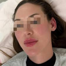 Aesthetics by Carmen Carter