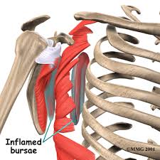 Image result for Scapulothoracic Injection