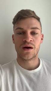 Does joshua kimmich have a beard? Joshua Kimmich Die Situation Ist Ernst Und