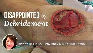 Eschars may be crusty or leathery in. Disappointed By Debridement Wcei