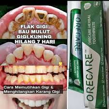 Memiliki gigi yang putih dan bersih tentu menjadi dambaan semua orang. Odol Pemutih Gigi Menghilangkan Karang Gigi Shopee Indonesia
