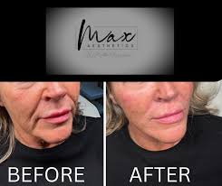 Max Aesthetics by Kate Harrison