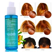 I wouldn't recommend it for male hair loss caused by dht excess (only in minor cases). Best Hair Oils For Faster Hair Growth 100 Natural China Hair Growth Oil Men Women Buy Hair Growth Serum Hair Growth Oil Hair Growth Product On Alibaba Com