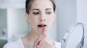 заеды в уголках рта причины и лечение у взрослых Angulyarnyj Stomatit Hejlit Lechenie Zaeda Vo Rtu Foto Prichiny