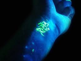 While mris can cause tattoo irritation, this happens only in rare cases. How Long Do Glow In The Dark Tattoos Last Uv Blacklight Body Art