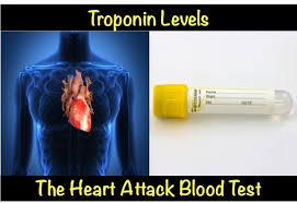 troponin levels the heart attack blood test myheart net