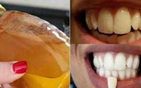 Bellezza Addio Ai Denti Gialli Con Questa Meravigliosa Ricetta Fatta In Casa Funziona Cosi Bene Che Vi Fara Viver Rimedi Naturali Rimedi Sbiancare I Denti