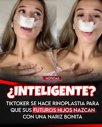 A TikTok influencer, Fiorella Castillo, has gone viral after claiming that  her recent rhinoplasty will ensure her future children are born with  "perfect" noses. The content creator posted photos from her hospital