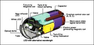Image result for Wireless Capsule Endoscopy