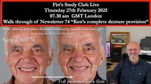 📢 Master Complete Dentures: Ken's Case Study & Live Webinar! 🦷 Join me  for an exclusive Study Club Live Webinar