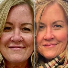 Melissa Resch *Restore Aesthetics* (@restore.aesthetics.az) • Instagram  photos and videos