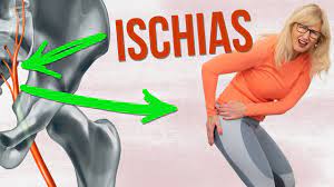 Ischias Schmerzen 2 Ubungen Sind Oft Ausreichend Liebscher Bracht