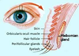 Autoimmunegal Sjogren S And Blepharitis Chronic Dry Eye Dry Eyes Blepharitis