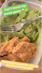 5 Tips For Eating Soft Gluten Free And Vegan Foods After Dental Surgery