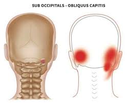 Pin On Anatomy Trigger Points