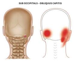 You may experience headaches in the back of your head if you have arthritis in your neck. Pin On Anatomy Trigger Points