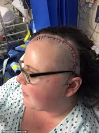 When we smell something that isn't there, though, this may be a sign of a serious health issue, according to dr. Woman Reveals She Discovered She Had A Brain Tumour After Smelling Burnt Toast Daily Mail Online