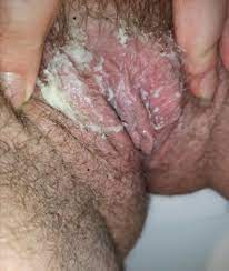 Unwashed dirty pussy - 78 photo